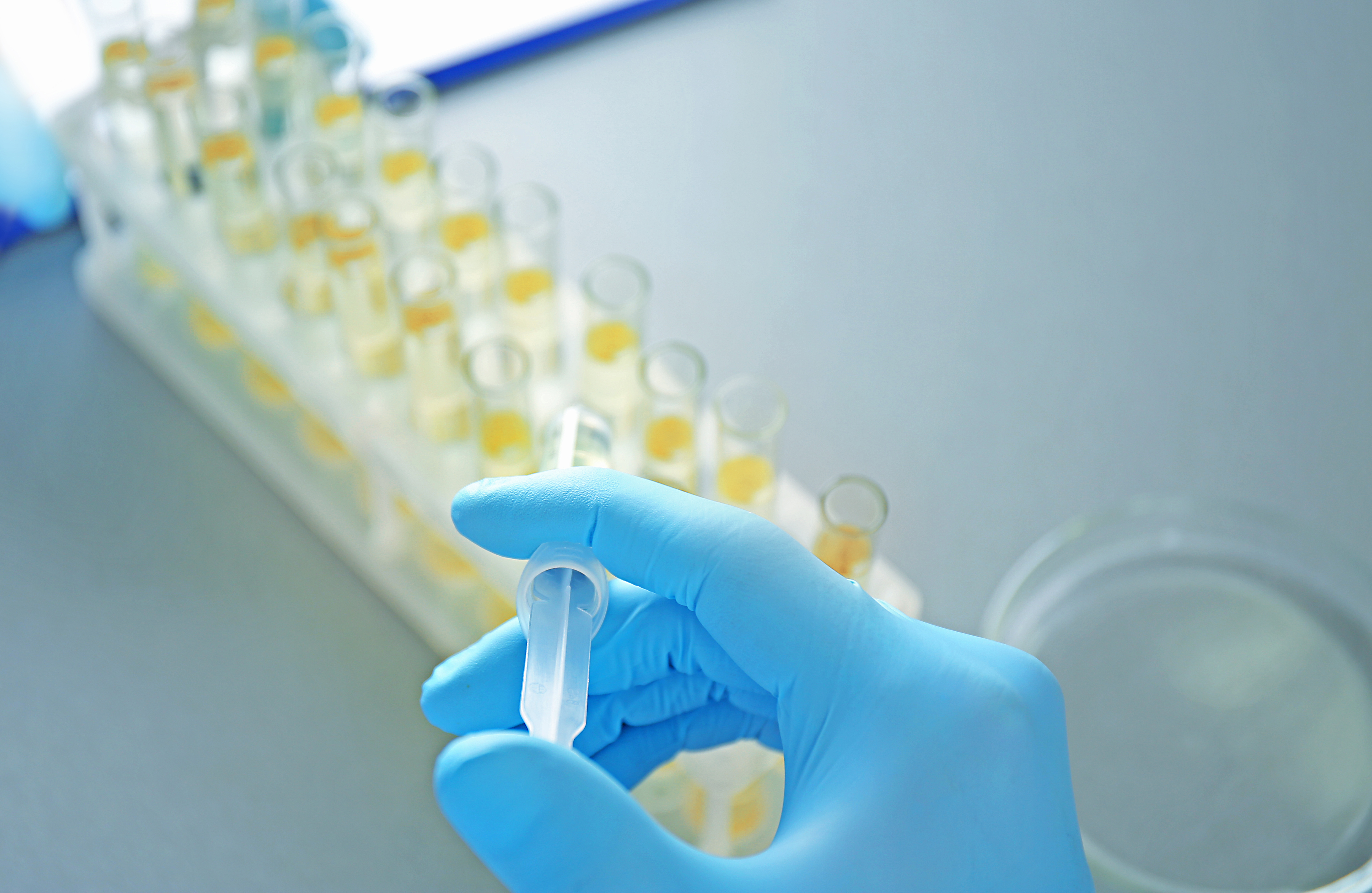 菌種轉(zhuǎn)運(yùn)